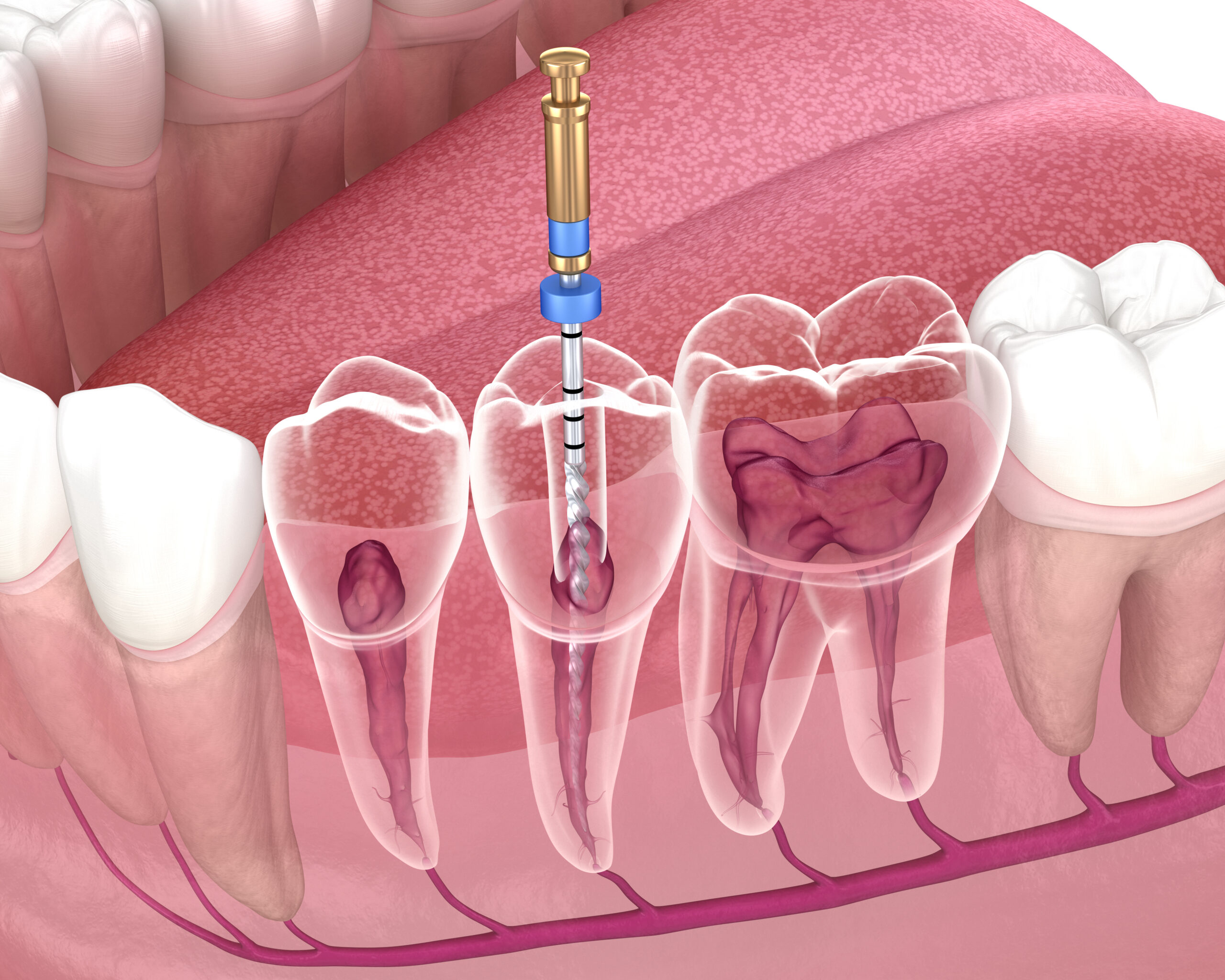 Endodontics