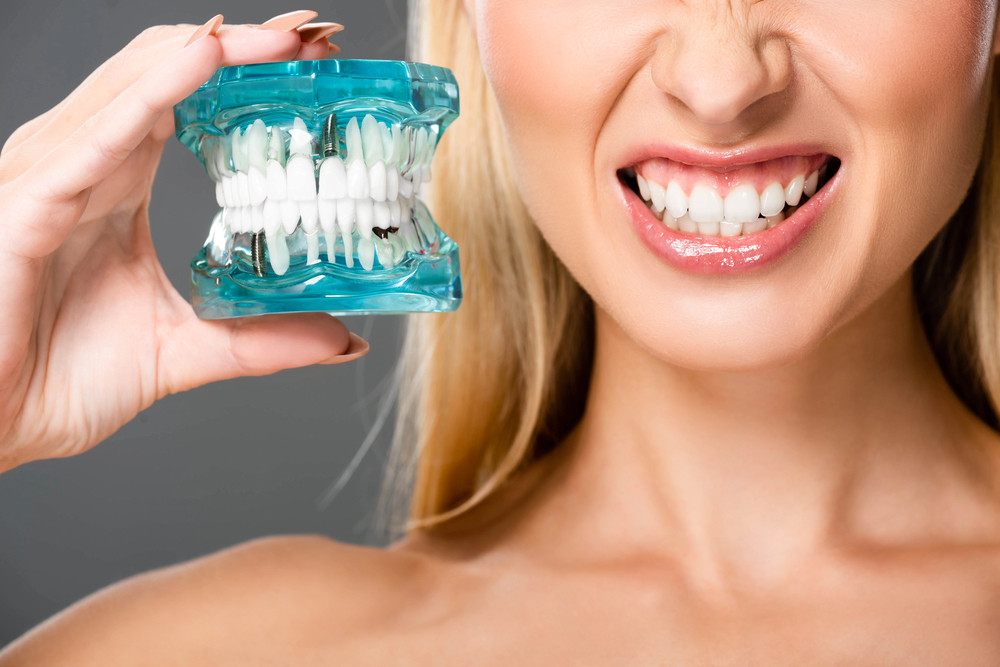 All on 4 Dental Implants Recovery Time: What to Expect During the Healing Process