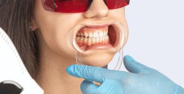 Dental Cleaning and Exam for Plaque Removal: Stop Build-Up Before It Becomes a Problem