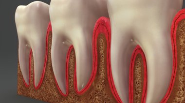 Periodontist for Bleeding Gums: Gentle Solutions for Lasting Relief