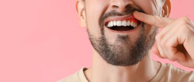 Periodontist for Receding Gums: Reverse Damage and Protect Your Smile