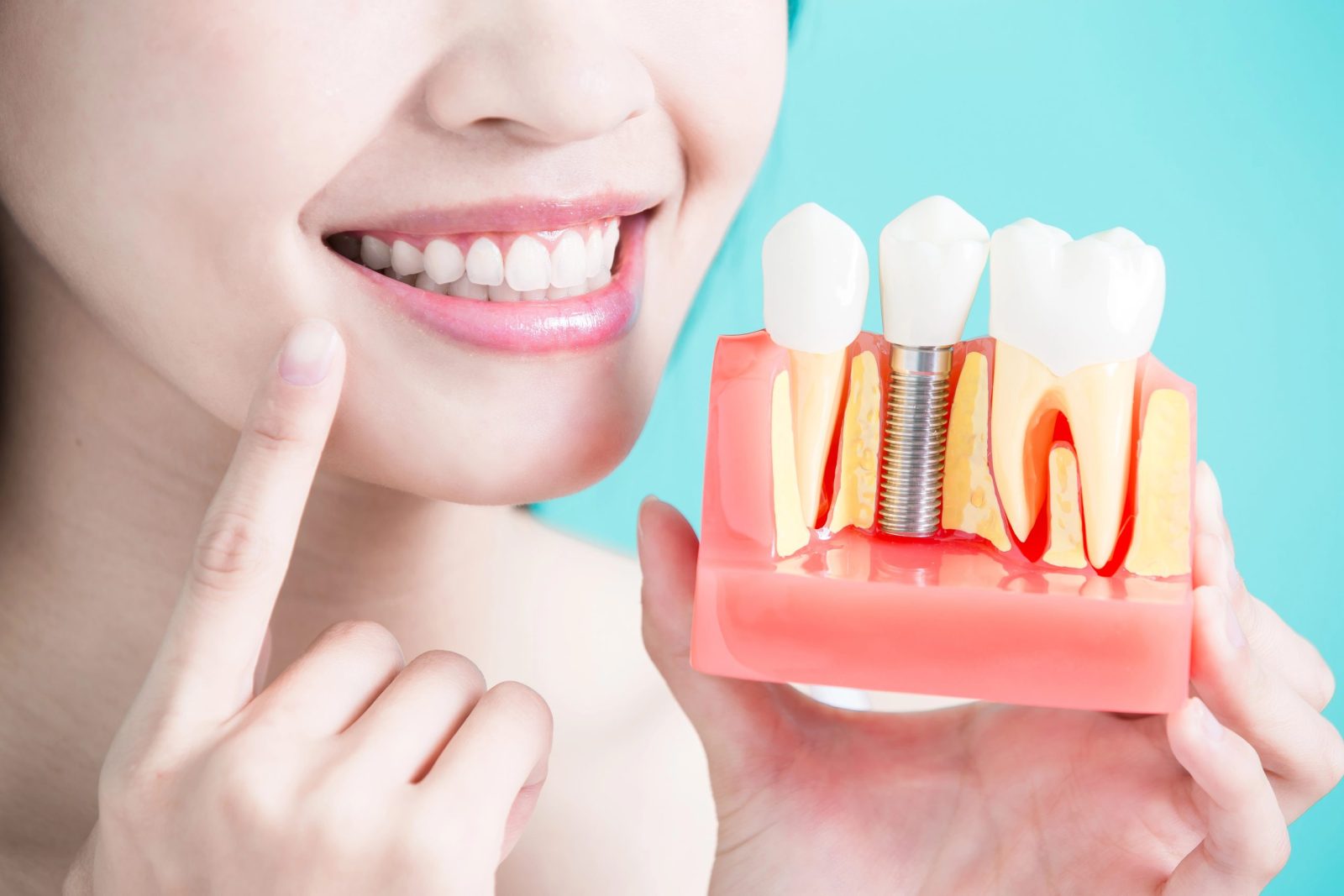 Cost of Dental Implants in Lake Hopatcong: What to Expect and How to Plan