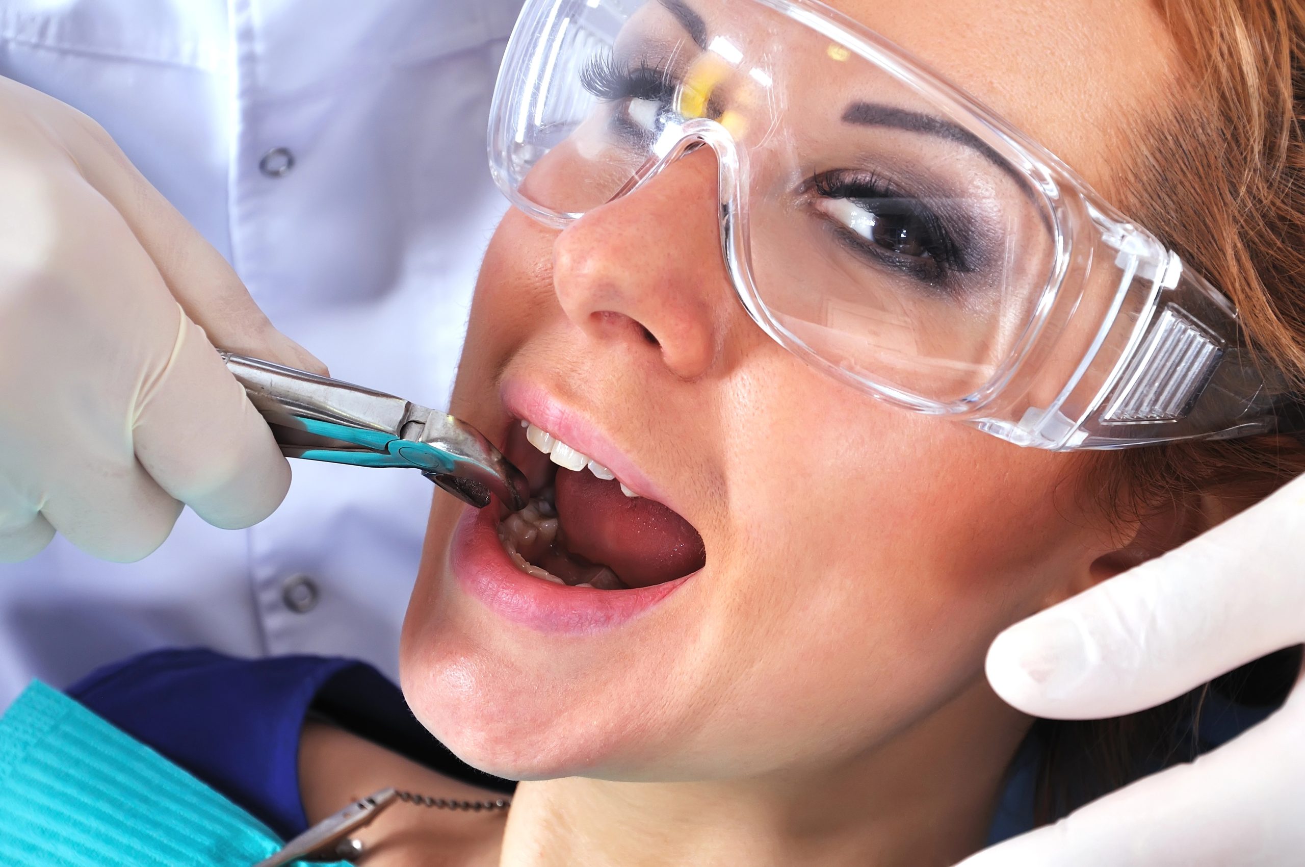 The Link Between Tooth Extraction and Orthodontics Explained