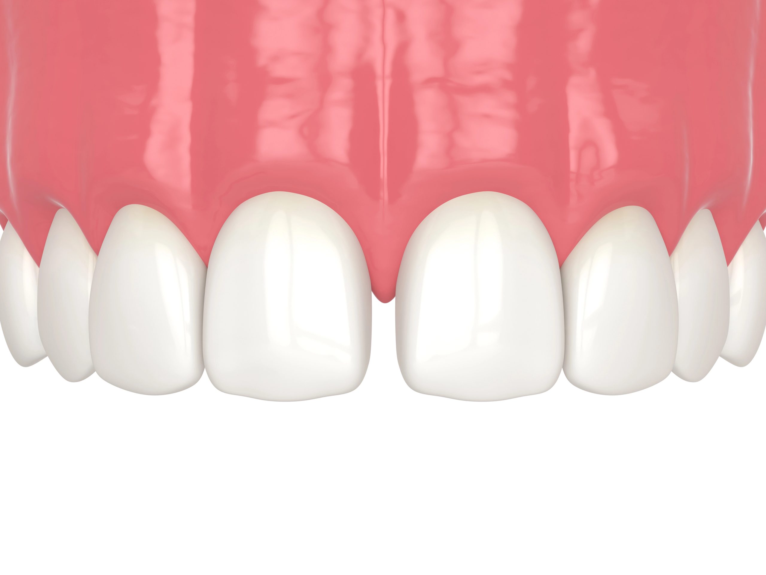 Cosmetic Tooth Bonding for Gaps: A Simple Way to Perfect Your Smile